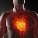 Можно ли стать здоровым после инфаркта?
